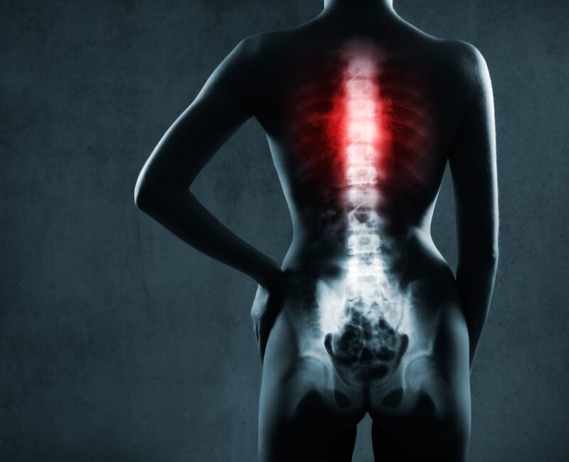 Spinal Cord Injury lawyer St. Amant, LA